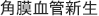 角膜血管新生